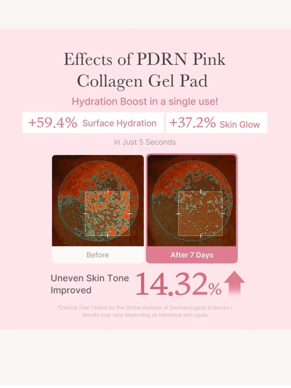 Medicube PDRN Pink Collagen Toning Gel Pads – Pink - Picture 5 of 11